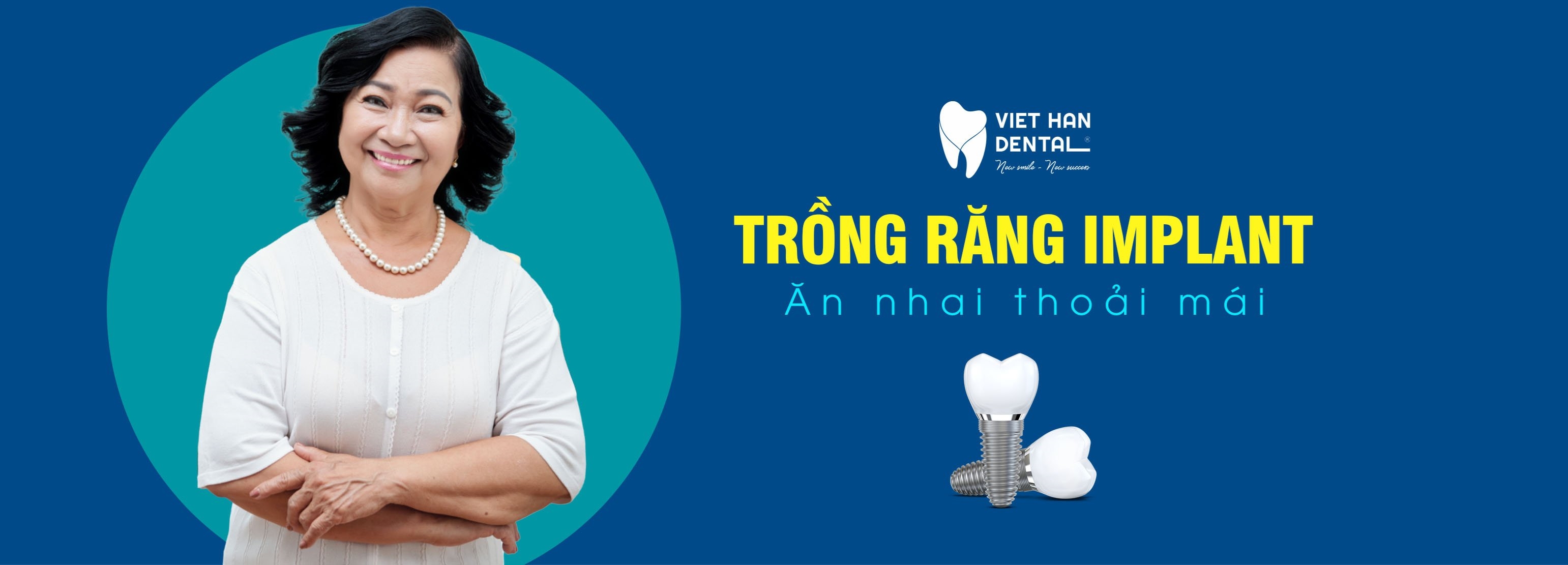 Trồng răng Implant