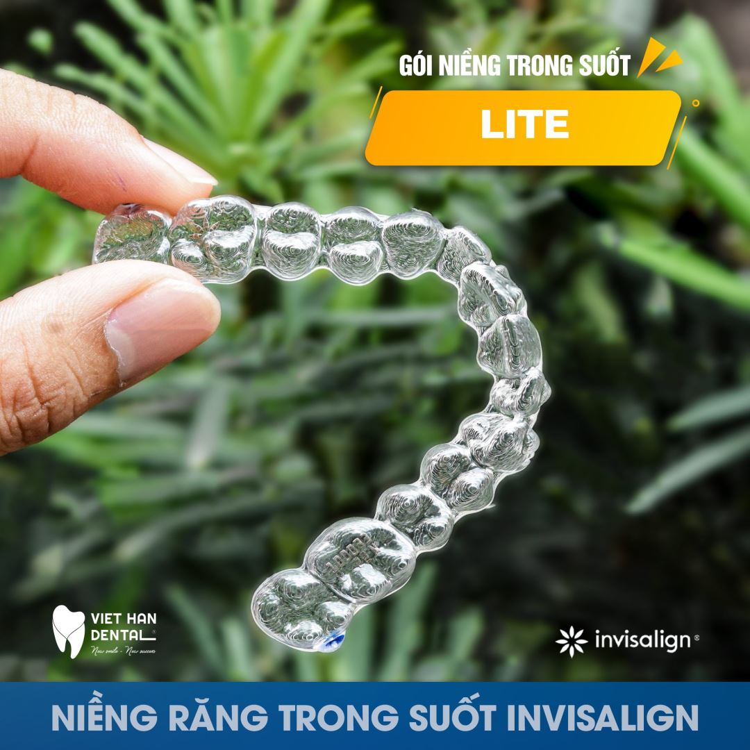 Invisalign Lite 