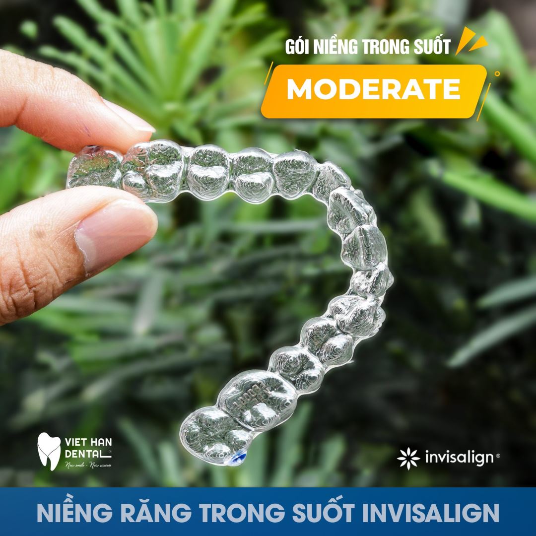 Invisalign Moderate