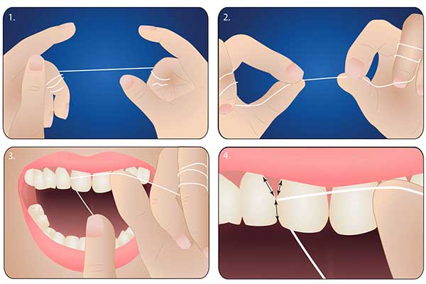 Hướng dẫn cách sử dụng chỉ nha khoa 