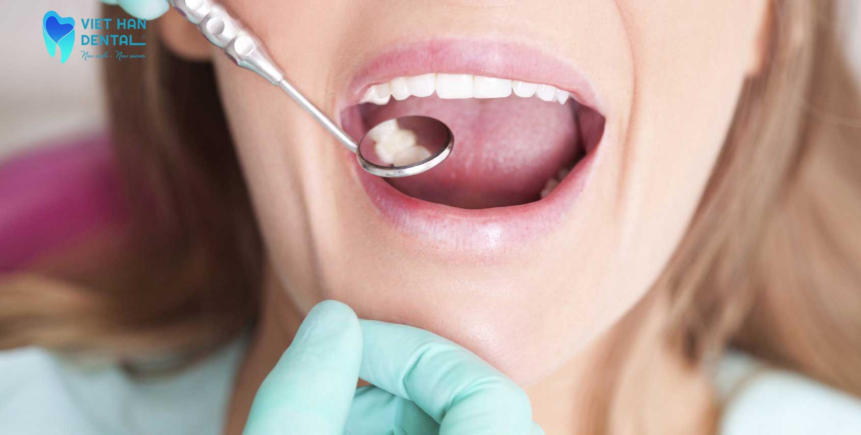 Những bệnh răng miệng thường gặp 