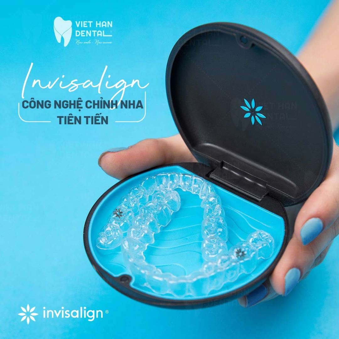 Niềng răng trong suốt Invisalign - giải pháp niềng ăn vượt trội giúp bạn thoải mái ăn uống 