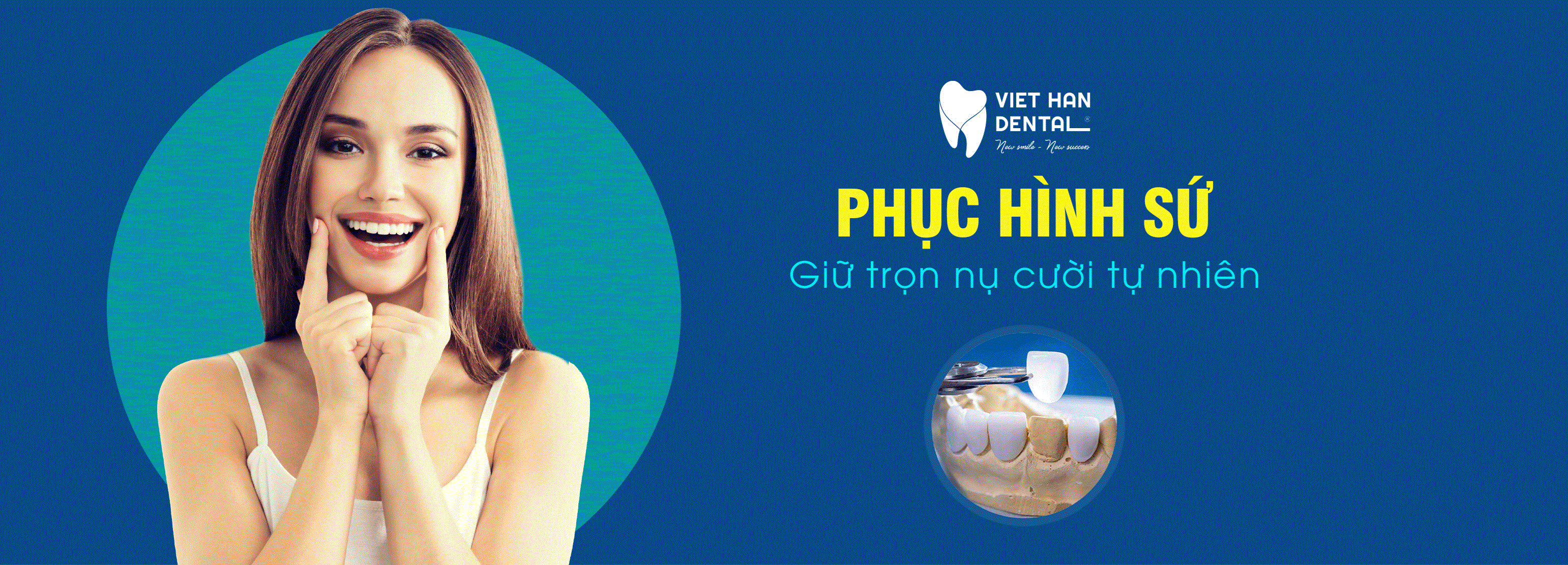 Phục hình sứ