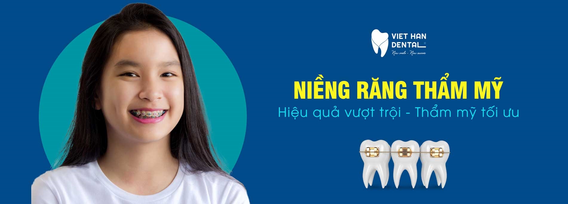 Niềng Răng Invisalign