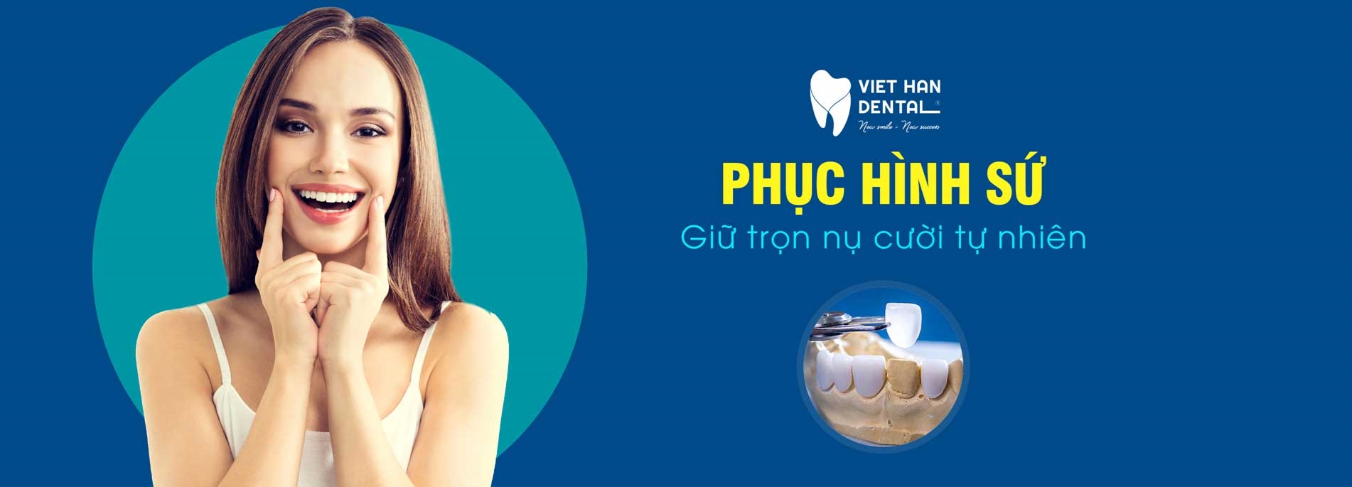 Tin Tức Phục Hình Sứ